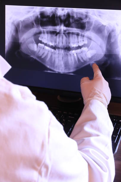 Best Walk-In Emergency Dentist in Hlsboro, IL