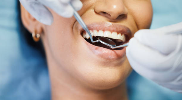 Best Emergency Tooth Extraction in Hlsboro, IL