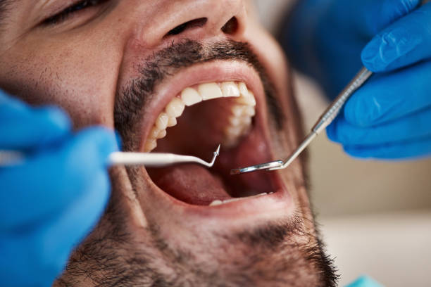 Best Emergency Broken Tooth Repair in Hlsboro, IL